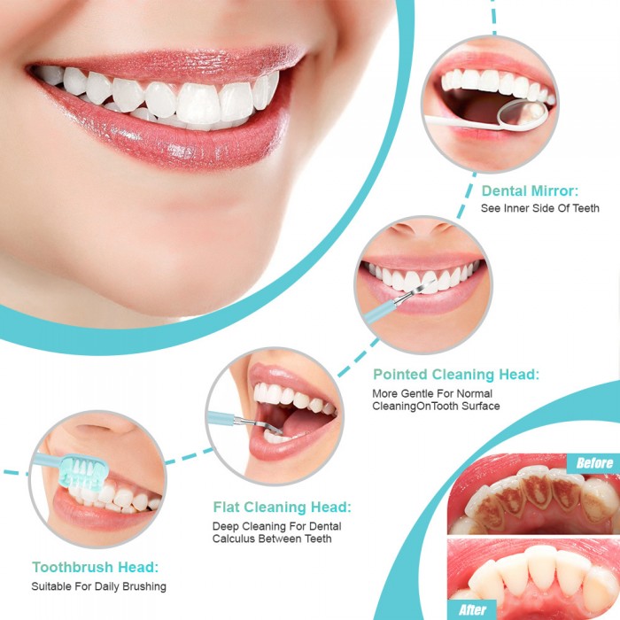 Multifunctional ultrasonic dental scaler (wireless charging), tooth brushing, calculus removal, tartar removal set