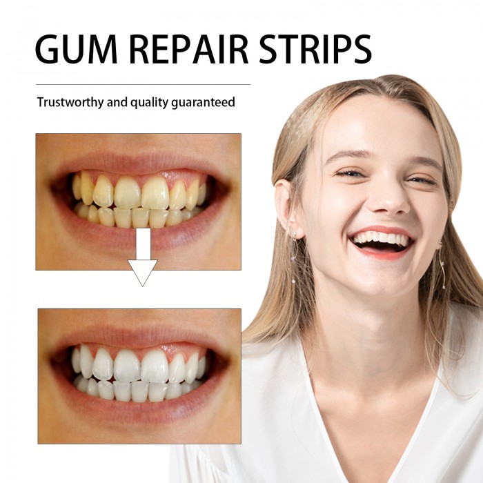 Hyaluronic acid whitening tooth strips (value pack of 35 pieces), containing vitamin C, whiten teeth quickly