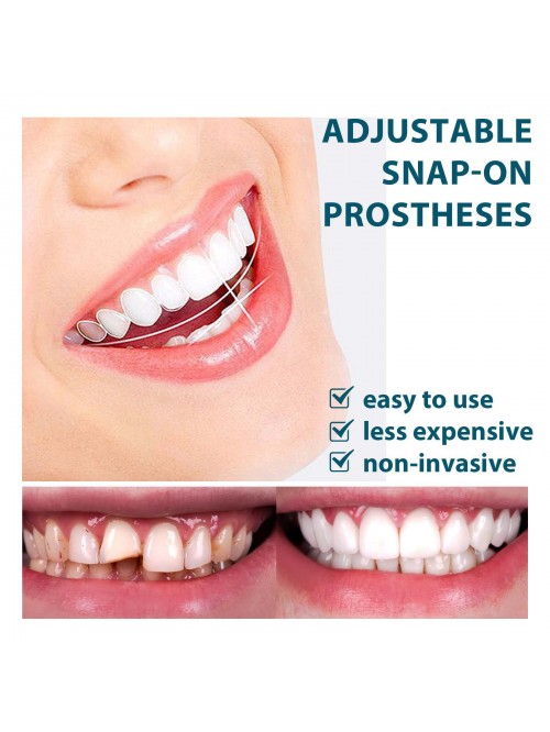 Adjustable snap-on denture kit (4 boxes of great v...